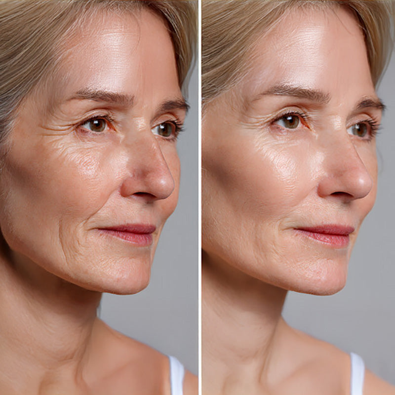 Clearlift Laser Treatment Face & Neck (3 Treatments)